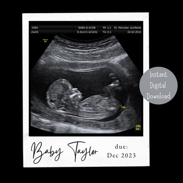 Instagram Pregnancy Announcement | Baby Announcement | Editable | Minimalist | Social Media | Polaroid| Gender Reveal | Digital Download