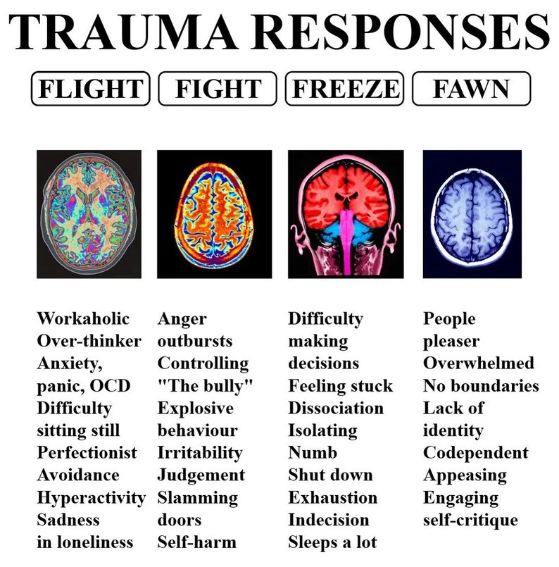 May include: A diagram illustrating four distinct trauma responses: Flight, Fight, Freeze, and Fawn. Each response is depicted with a brain scan image and a list of associated behaviours.