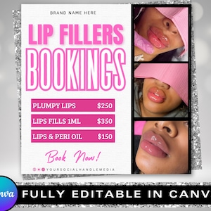 Pode incluir: Um gráfico rosa e branco com o texto "LIP FILLERS BOOKINGS" em letras grandes de cor rosa. O gráfico lista os preços de três serviços de preenchimento labial: Plumpy Lips, Lips Fills 1ML e Lips & Peri Oil. O gráfico também inclui três fotos de lábios com preenchimento labial.
