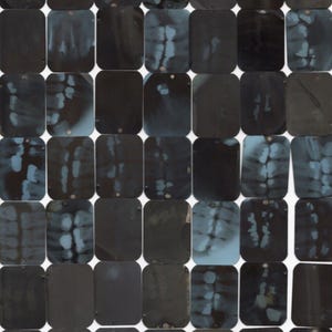 Lote de 25 diapositivas de radiografías dentales Radiografías de dentista Fetiche de dientes
