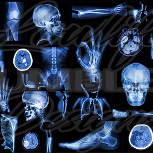 Könnte beinhalten: Eine Collage aus verschiedenen Röntgenbildern verschiedener Körperteile, darunter Schädel, Wirbelsäule, Hände, Füße und Brustkorb.