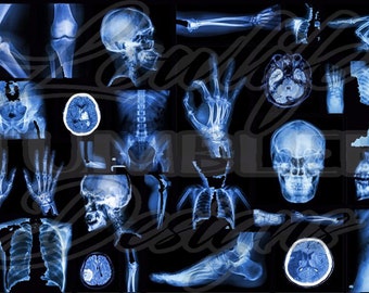 Röntgenfoto naadloos patroon, schedelstof, schedel clipart, schedel, schedelbeker wrap, schedel naadloze, verpleegkundige digitaal papier, schedelpapier, röntgenfoto's