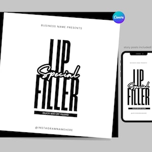 Lip Filler Special Flyer, Flyer for Lip Fillers, Esthetician Flyer, Hyaluron Lip Filler, Lip Filler Sale, Appointments for Lip Filler