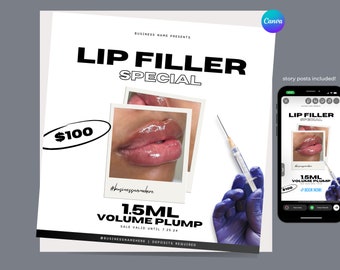 Flyer especial para preenchimento labial: modelo para esteticista (download digital)
