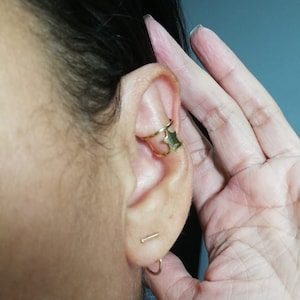Big ear corrector