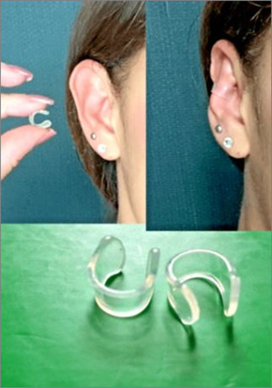 Correzione dell'orecchio per la cura della pelle, correttore auricolare  cosmetico, soluzione per orecchie sporgenti, adesivi auricolari per orecchie  grandi, cerotti per correzione dell'orecchio in silicone 30, self-ad