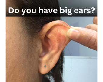 Prominent ear? earrings to straighten large ears