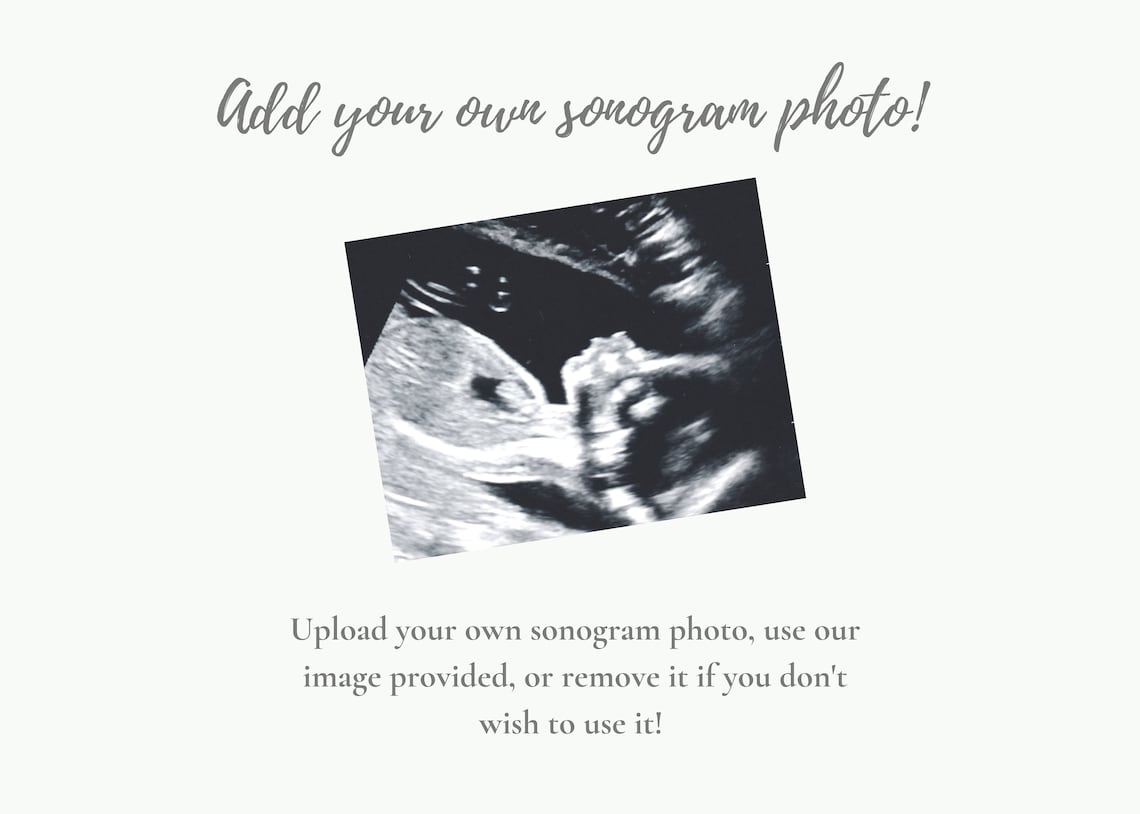 It's A Boy Digital Pregnancy Announcement Customizable Image Boy Gender