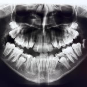 Dental X-Ray Films | Real Vintage Medical Dentistry Education Teeth Curiosity | Mystery Pull Oddity