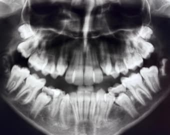 Dental Bone Photo Films Real Vintage Medical Dentistry Education Teeth  Curiosity Mystery Pull Oddity