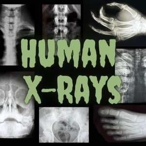 Vintage X-Ray Films - Real Medical Education Curiosity - Mystery Oddity Decor