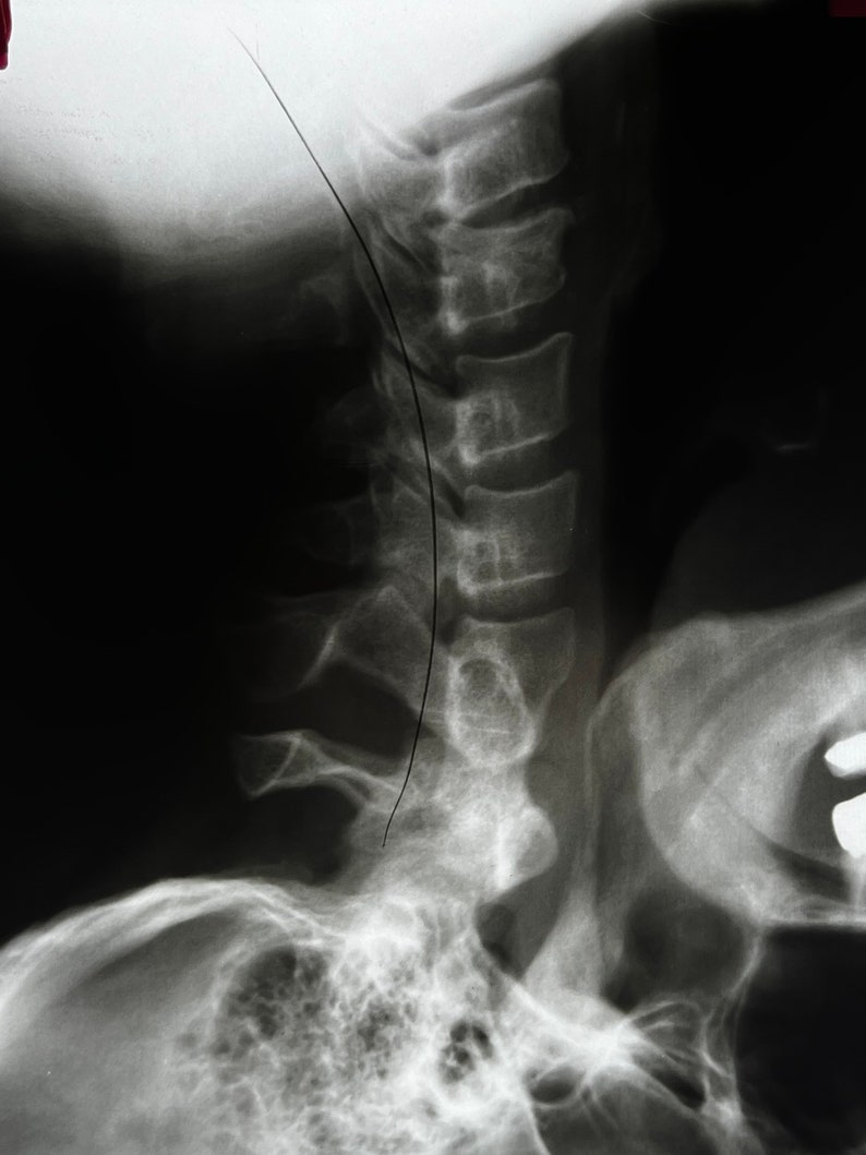 Neck X-Ray