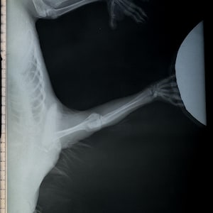 May include: X-ray image of a possum's arm and shoulder. The image shows the bones of the arm and shoulder, as well as the surrounding tissue. The image is labeled "Possum" and "4/1/08".