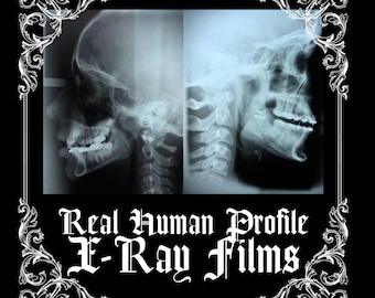 Real Human Head Profile Photo Films | Medical Education Curiosity Ephemera | Curio Cabinet Oddities