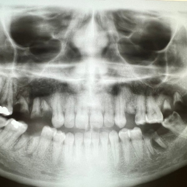 Dental X-Ray Films - Real Vintage Medical Dentistry Education Teeth Curiosity - Mystery Pull Oddity