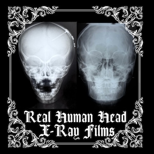 Real Human Head Photo Films | Medical Education Curiosity Ephemera | Curio Cabinet Oddities