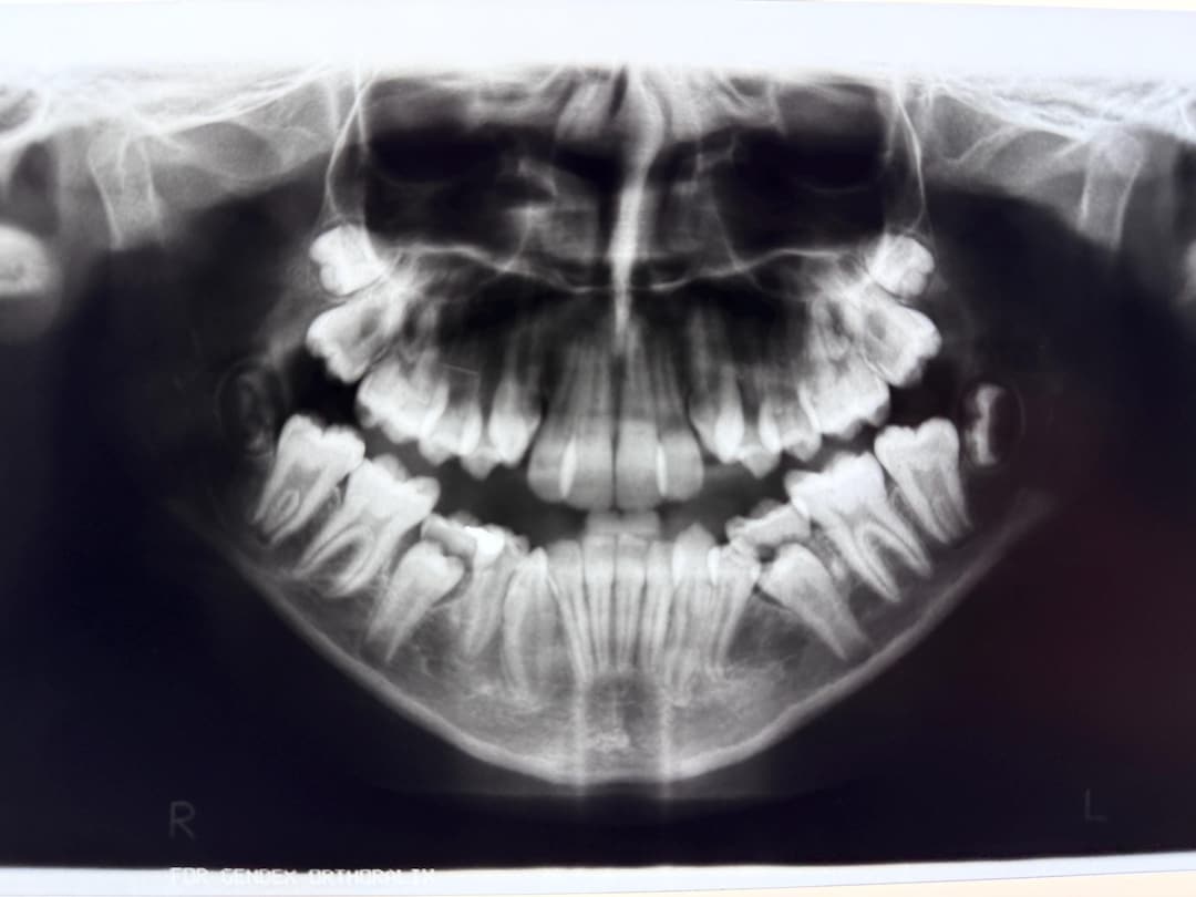 Dental Bone Photo Films Real Vintage Medical Dentistry Education Teeth  Curiosity Mystery Pull Oddity