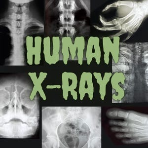 Real Human X-Ray Filmsammlung | Echte Medizinische Edukation Kuriosität | Mystery Pull Oddity DIY Dekor