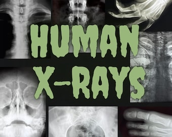 Real Human Bone Photo Film Collection | Real Medical Education Curiosity | Mystery Pull Oddity DIY Decor
