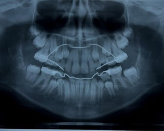 Dental Bone Photo Films  | Real Vintage Medical Dentistry Education Teeth Curiosity | Mystery Pull Oddity
