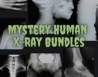 Mystery Bone Photo Films | Real Medical Education Curiosity | Oddity Decor Craft Display