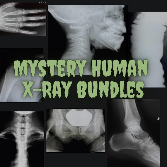 Mystery Bone Photo Films | Real Medical Education Curiosity | Oddity Decor Craft Display