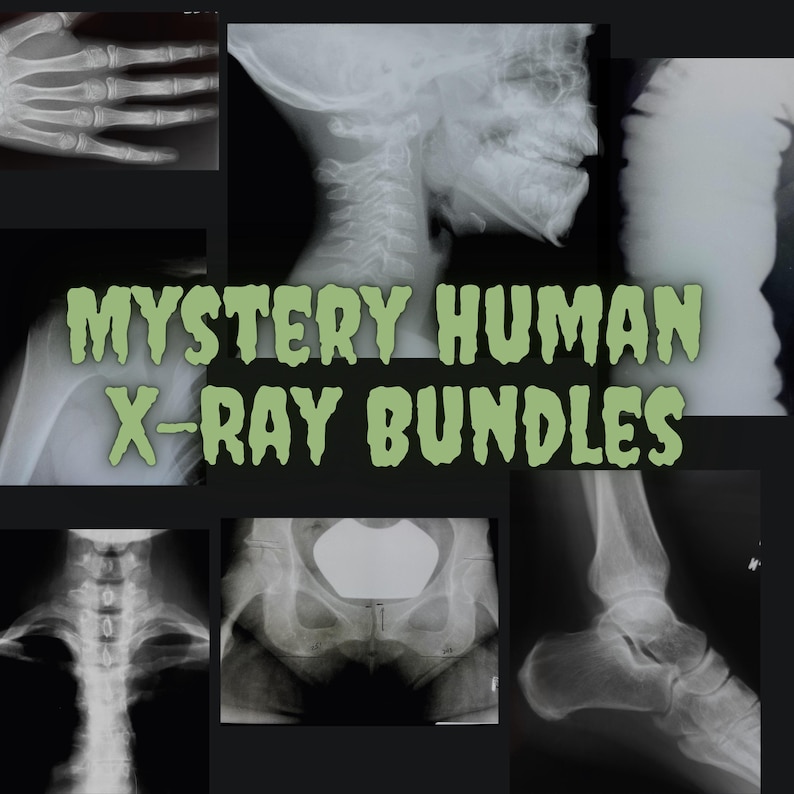 Pu&ograve; includere: Un collage di immagini radiografiche in bianco e nero di diverse parti del corpo umano. Le immagini includono una mano, un collo, una spalla, un bacino e una caviglia. Il testo "MYSTERY HUMAN X-RAY BUNDLES" &egrave; sovrapposto alle immagini.