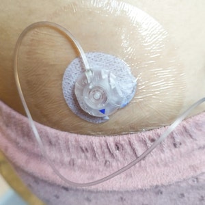 Medtronic Infusion Set Parches protectores transparentes Parches para diabéticos Paquete de 30 imagen 2
