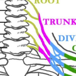 Puede incluir: Diagrama del sistema nervioso humano, que muestra la raíz, el tronco y las divisiones de un nervio. La raíz se muestra en verde, el tronco en rosa y las divisiones en azul.