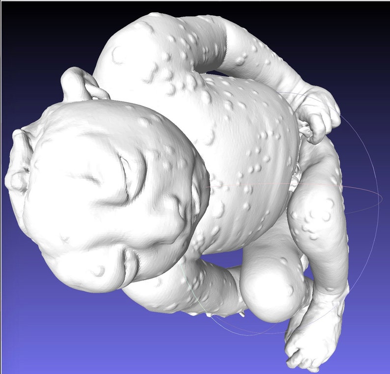 Anacephalic Rare High Resolution 3D Scan Human Fetus 36 Weeks Old Congenital Defect ANACEPHALY image 3