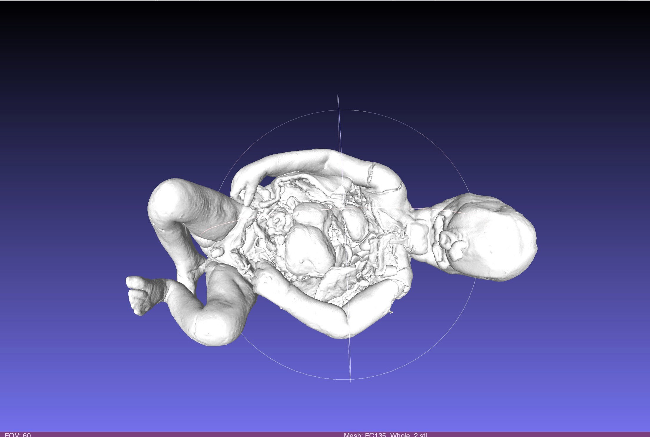 CYCLOPS Rare High Resolution 3D Scan Human Fetus 36 Weeks