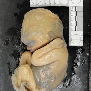 NEW!~ Rare High Resolution 3D Scan Human Fetus 14 Weeks Old 100 yr old MEDICAL SPECIMEN