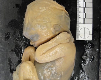 NEW!~ Rare High Resolution 3D Scan Human Fetus 14 Weeks Old 100 yr old MEDICAL SPECIMEN