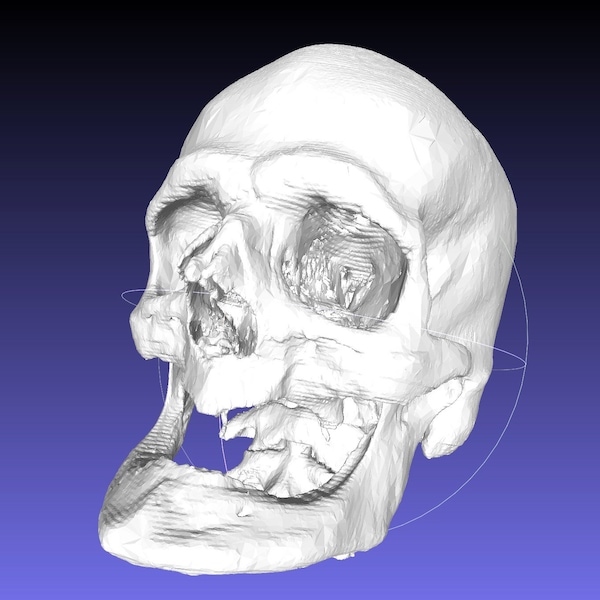 Unusual Male Skull, Edentulous (toothless), Quality High Resolution STL // Unautopsied Modern Human CT SCAN. Anthropology / Anatomy /