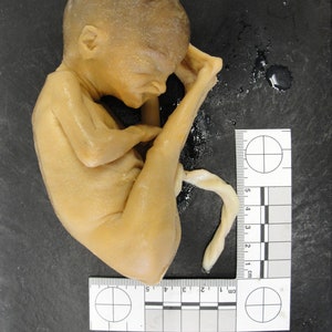 NEW!~ Rare High Resolution 3D Scan Human Fetus ~16 Weeks Old 100 yr old MEDICAL SPECIMEN
