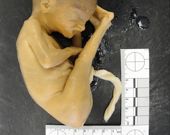NEW!~ Rare High Resolution 3D Scan Human Fetus ~16 Weeks Old 100 yr old MEDICAL SPECIMEN