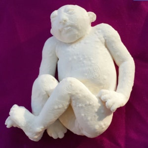 Anacephalic Rare High Resolution 3D Scan Human Fetus 36 Weeks Old Congenital Defect ANACEPHALY image 4