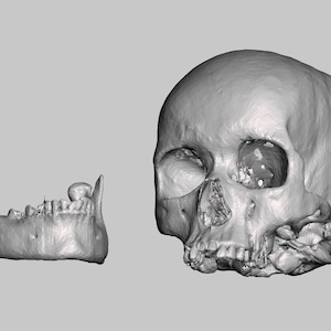 African American Female Unautopsied Skull and Jaw (Modern Human CT SCAN). High Resolution STL // anthropology / Anatomy / Halloween Prop