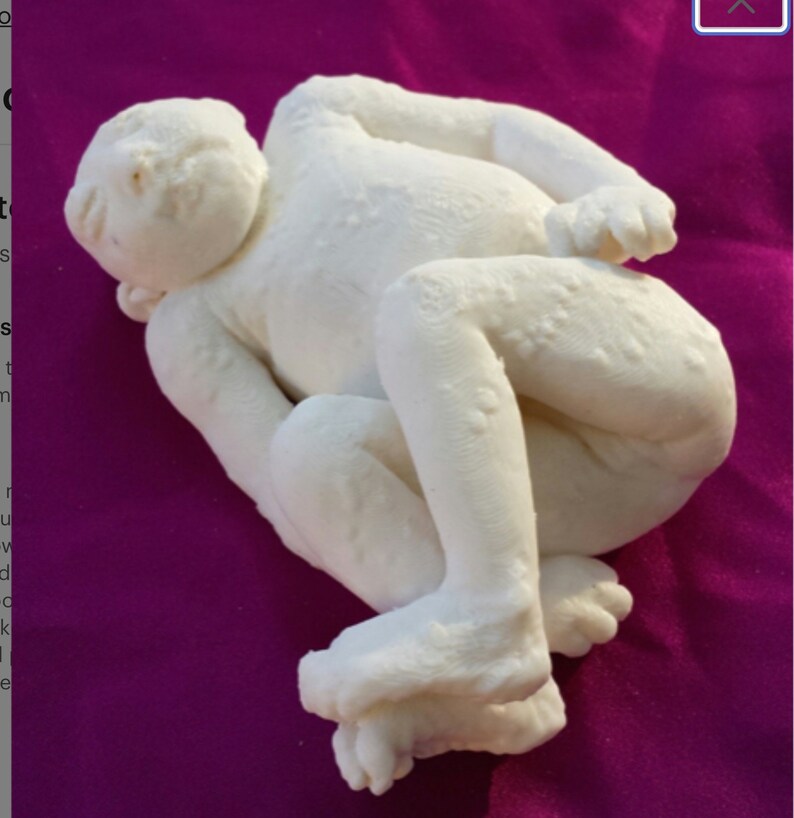 Anacephalic Rare High Resolution 3D Scan Human Fetus 36 Weeks Old Congenital Defect ANACEPHALY image 6