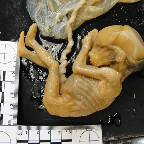 NEW!~ Rare High Resolution 3D Scan Human Fetus 16-20 Weeks Old 100 yr old MEDICAL SPECIMEN
