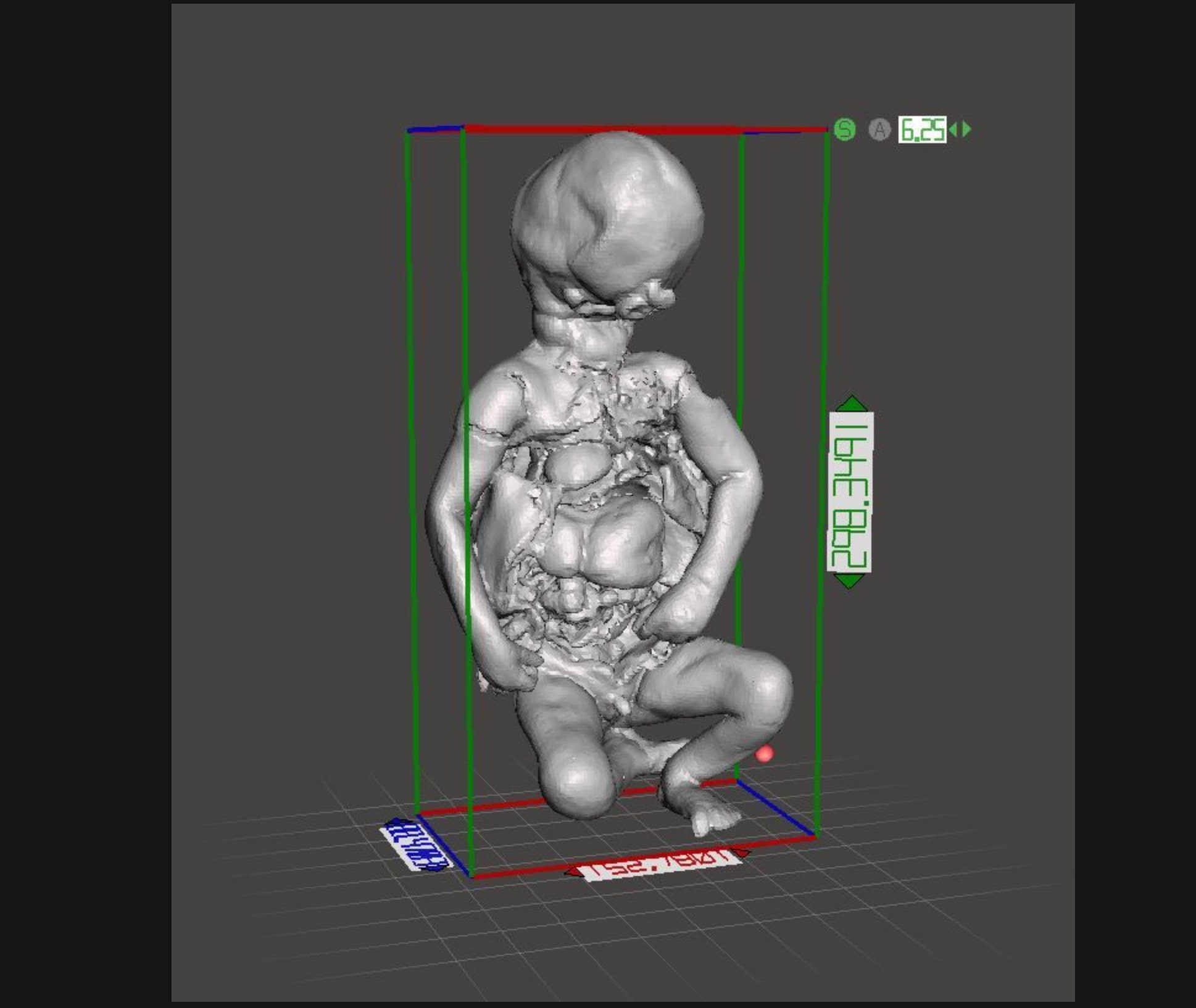 CYCLOPS Rare High Resolution 3D Scan Human Fetus 36 Weeks