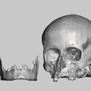 Female Undetermined Ancestry Skull, Autopsied (Modern Human CT SCAN), Museum Quality High Resolution STL // anthropology / Anatomy /