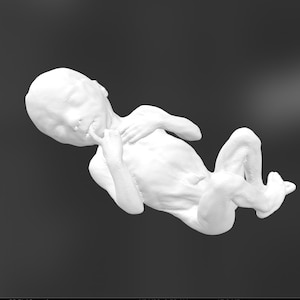 Rare High Resolution 3D Scan Human Fetus 24 Weeks Old