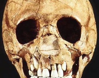 May include: A close-up of a human skull with visible teeth. The skull is light brown and has a rough texture.