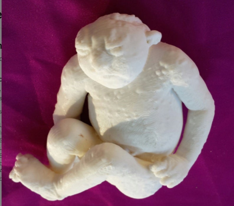Anacephalic Rare High Resolution 3D Scan Human Fetus 36 Weeks Old Congenital Defect ANACEPHALY image 5