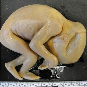 以下が含まれることがあります： 黒い表面に胎児の体勢で置かれた、薄い肉色のヒトの胎児。画像の下部に定規が見える。