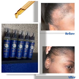 Magical Hair Growth Oil