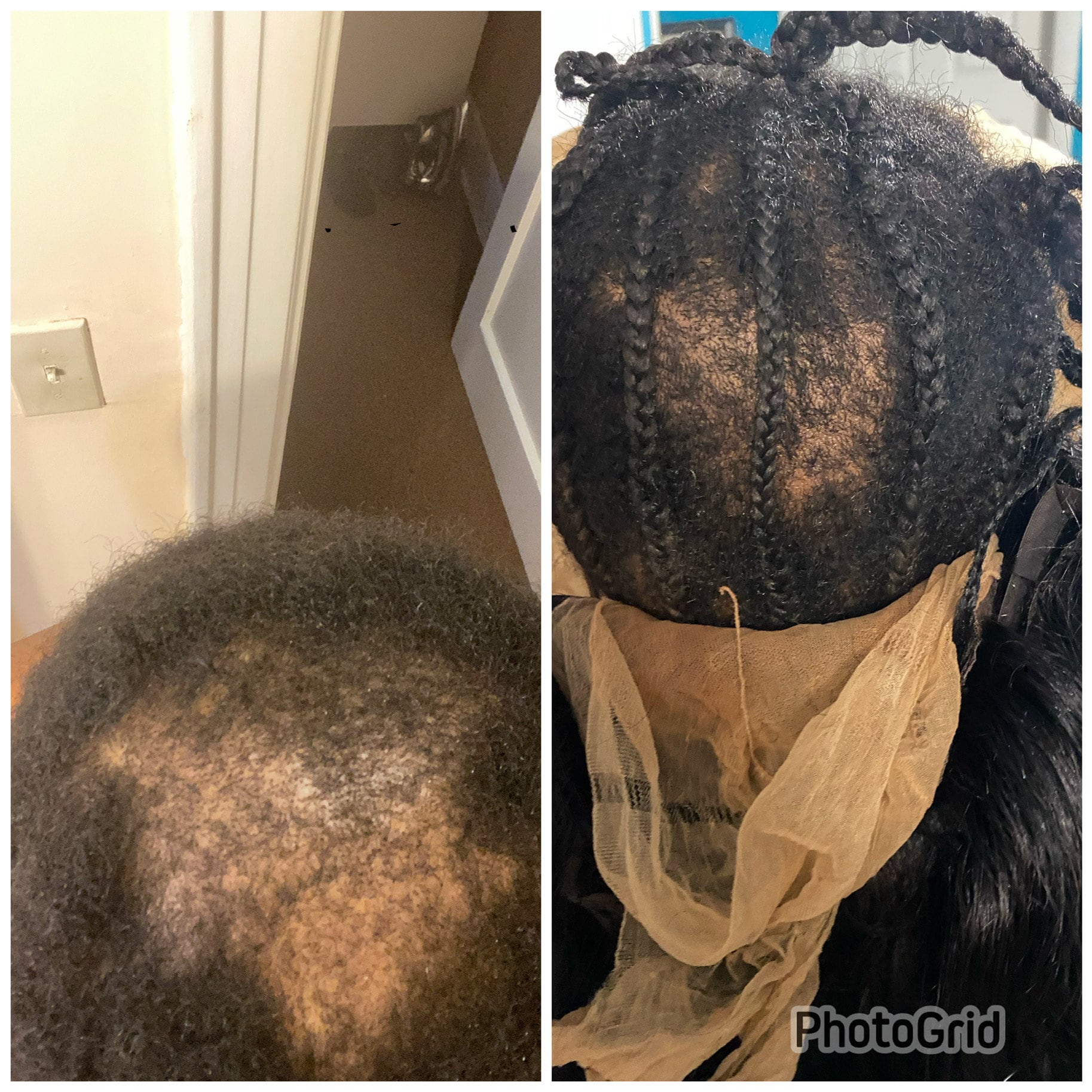 Is Your Hair Tingling?  Could This Be A Sign Of Rapid Growth? - 7ram919