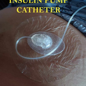 Cerotti trasparenti adesivi per pompe per insulina