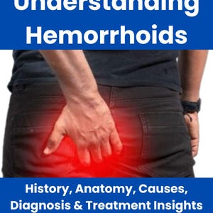 Understanding Hemorrhoids: History, Anatomy, Causes, Diagnosis & Treatment Insights for Comprehensive Care! PDF Download!